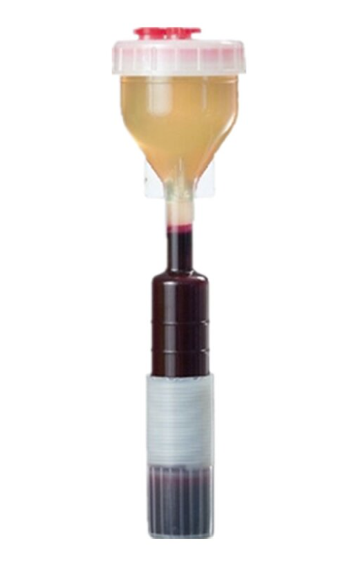 PRP behandeling procedure